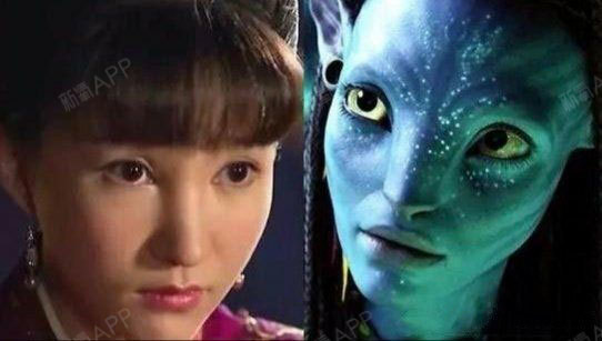 但很多做完玻尿酸隆鼻的求美者发现,鼻子的山根变宽,像阿凡达一样,这