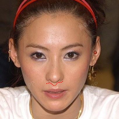 为什么杨幂和娜扎都整了鼻子,正面还是露鼻孔,原来问_圈子-新氧美容