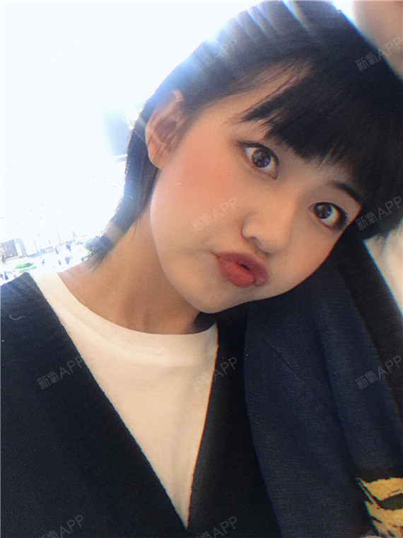 激光祛斑好不好_效果图_萌系恶女激光祛斑术