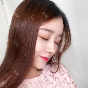 鼻头有点弧度了,之前的鼻子太呆板了,没有灵性的感觉_圈子-新氧美容