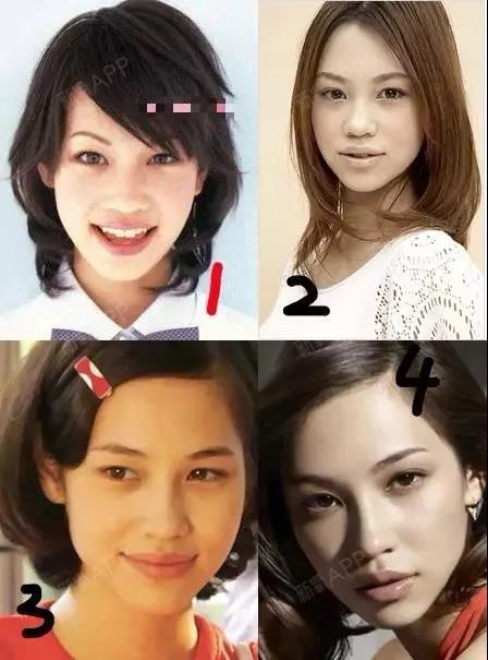 整形医生眼中的"最美"女星 如今整容行业高速发展的_圈子-新氧美容