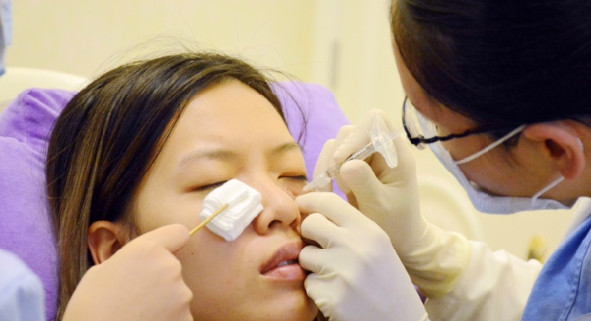 玻尿酸隆鼻怎么样_恢复过程_效果如何_大哥是