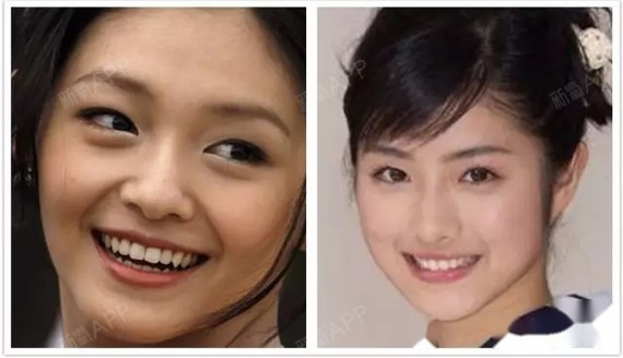 现在很多人都意识到了牙齿的重要性,除了美观和健康