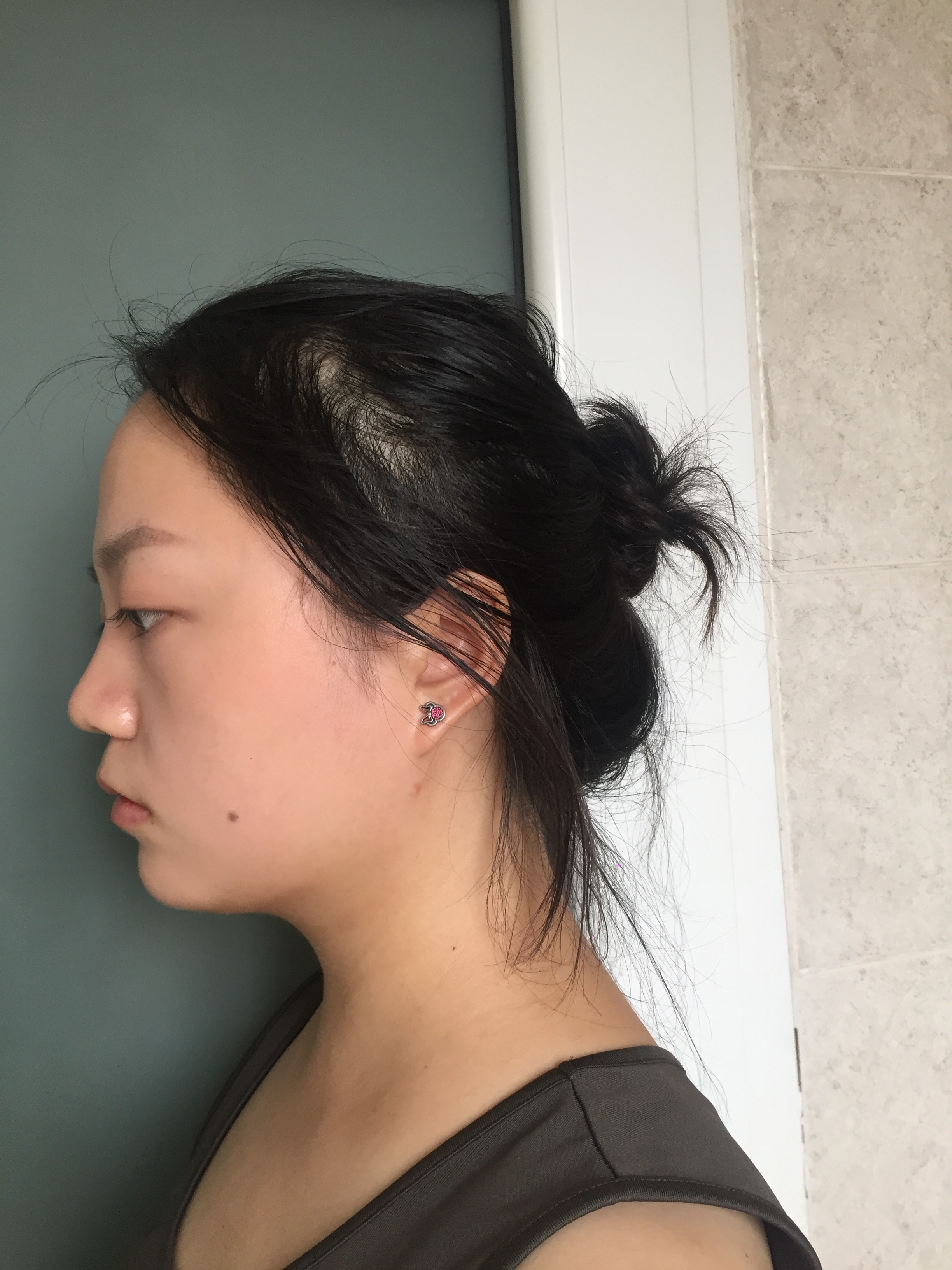 两个月的改变是很明显的,脸小了,脖子更长了,双下巴也消掉了