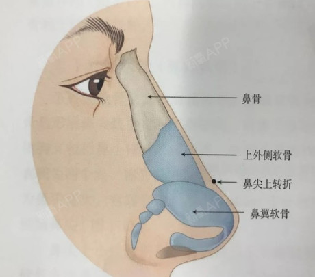 鼻骨在哪里图片图片