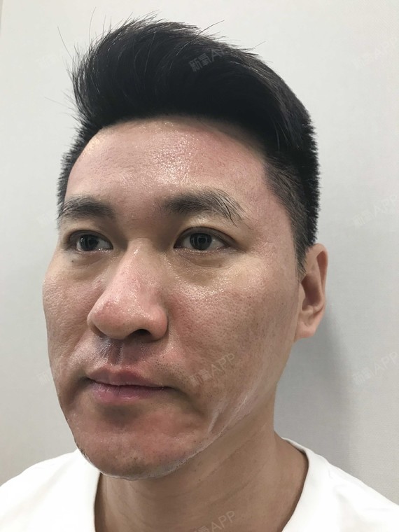 作为男人,皮肤粗糙感觉像是比较正常的发展规律,但哪_圈子-新氧美容