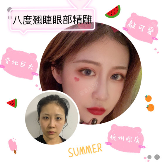 八度翘睫眼部精雕--双眼皮探店攻略杭州探店