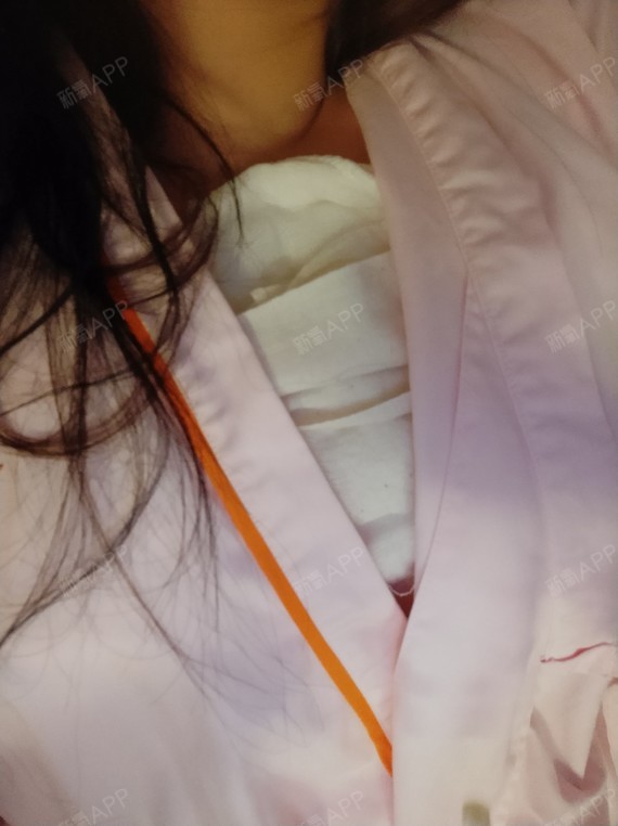 【杭州艺星假体隆胸术后3天】