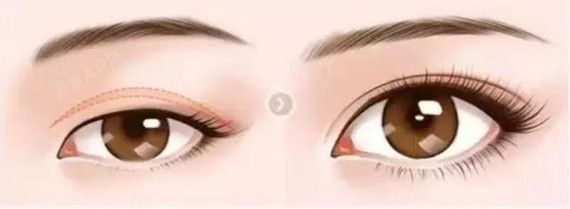 首页 此页面仅支持预览 Avatar 氧气zz927 3篇日记 每个人都希望自己有一双美丽的眼睛 眼部整形就成为大家的首选 在做眼部整形前 你有顾忌吗 接下来 圈主来为你科普一下眼部整形你可能会顾忌的问题在做眼部手术前 应该做哪些准备呢 术前常规检查