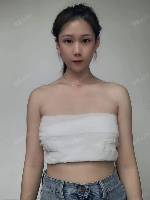 隆胸后的女装生活图片