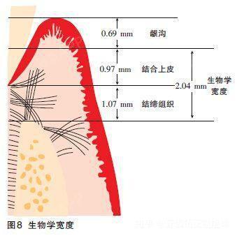 如上图所示,所谓的生物学宽度, 牙肉与牙齿结合的最上