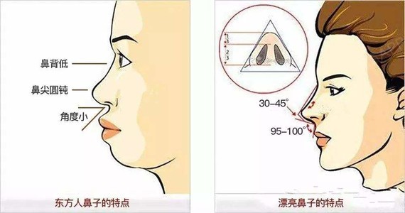 鼻基底填充位置图片