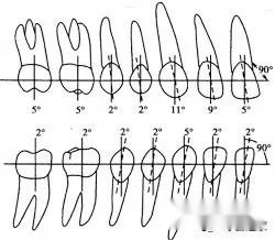 很多人最初来整牙的目的都是因为牙齿不整齐,看起来不美观,矫正牙齿的