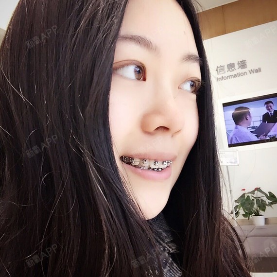 hello小钢牙~从今天开始我会跟你好好相处哒,请多指教:-) 戴