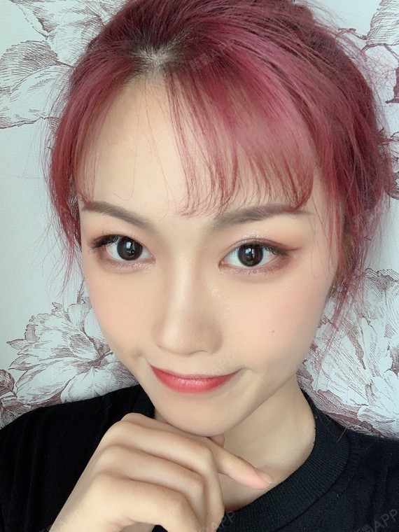 假体隆鼻以后还需要取出假体吗隆鼻假体有保质