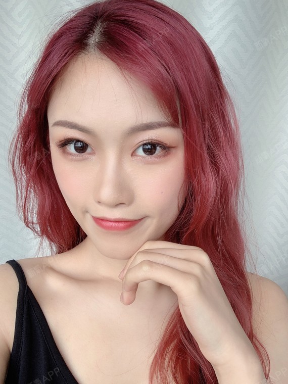 假体隆鼻以后还需要取出假体吗隆鼻假体有保质