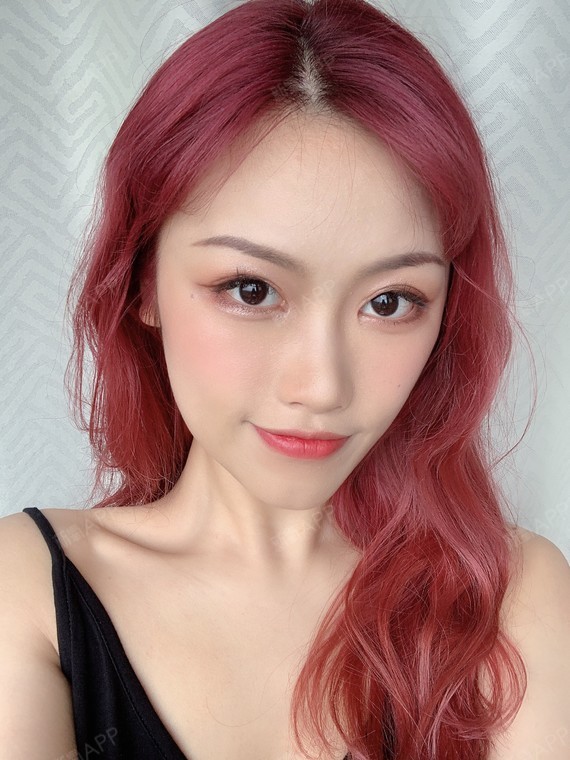 假体隆鼻以后还需要取出假体吗隆鼻假体有保质