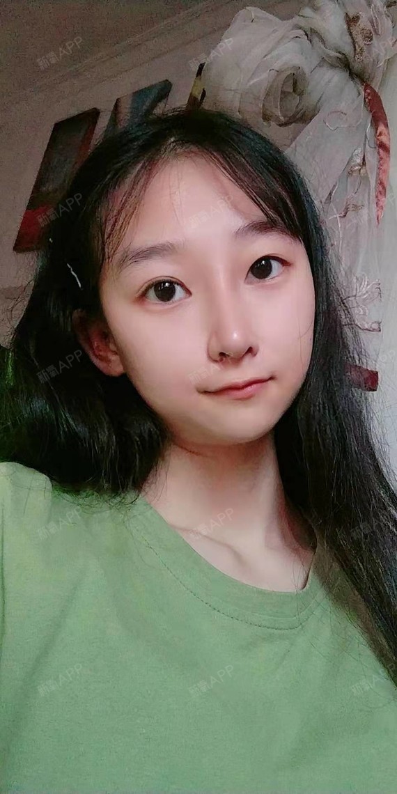 鼻子已经有形态了,看的出来真的很小巧的样子,现在鼻_圈子-新氧美容