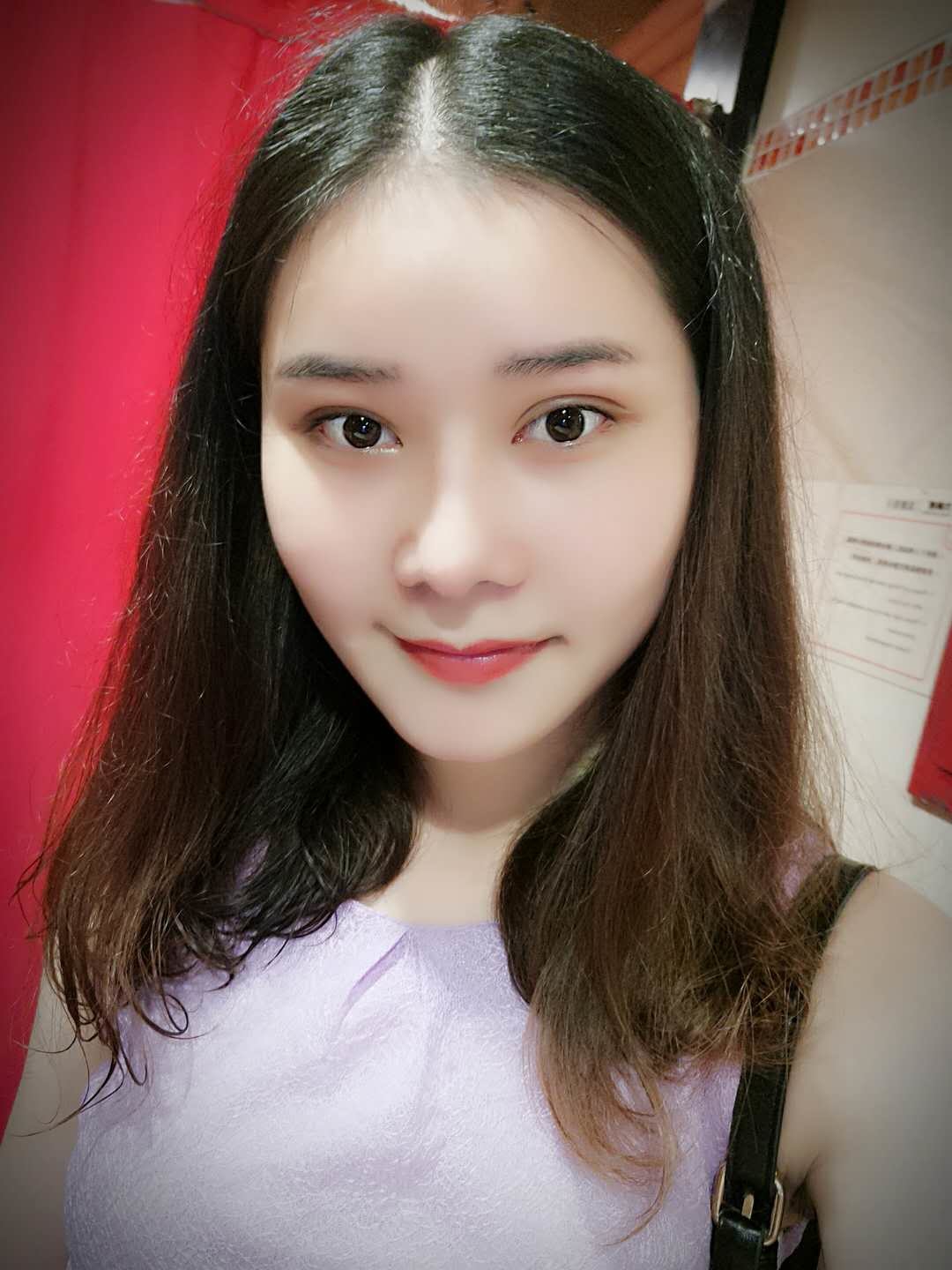 膨体隆鼻手术效果自然吗?膨体隆鼻手术效果_