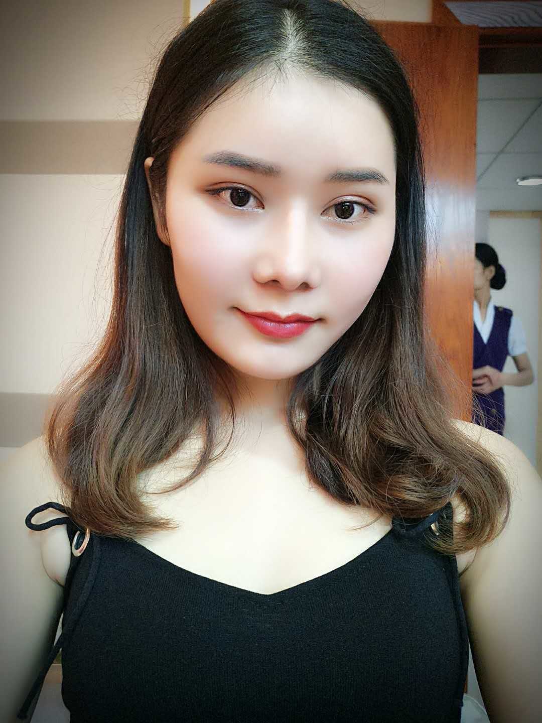 膨体隆鼻手术效果自然吗?膨体隆鼻手术效果_