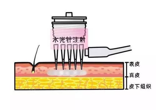 关于水光补水的6大误区你中招了没
