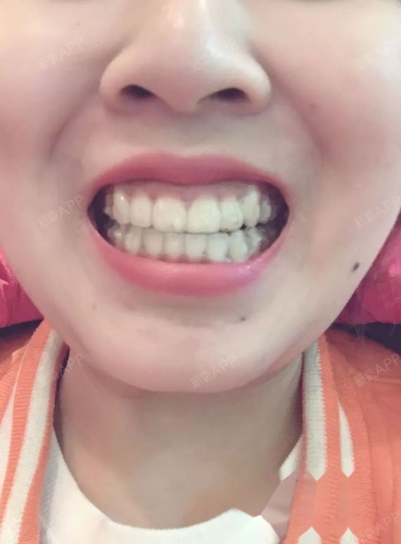 正雅28/30,完全没有当初的小鹿乱撞哈哈哈