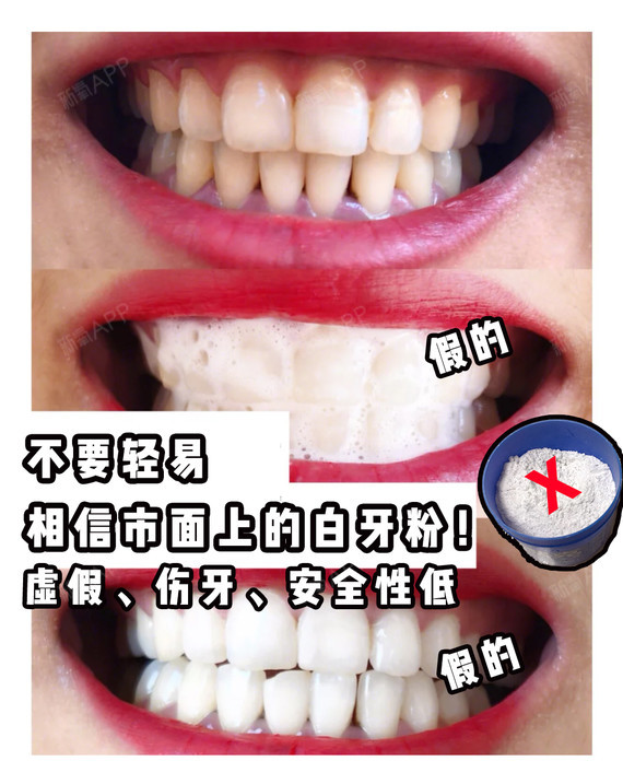 不要轻易相信那些所谓的洗牙粉 白牙粉啦 27 圈子 新氧美容整形