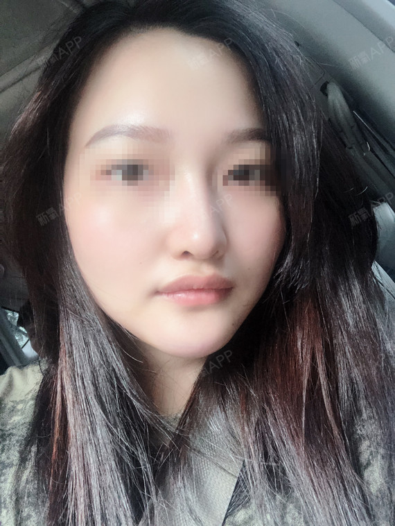 以前一直听奶奶那一辈的人说,下巴圆润有福,而且有下_圈子-新氧美容