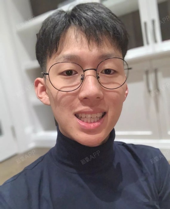 龅牙下巴后缩,初恋很反对,说男的变帅就变坏.