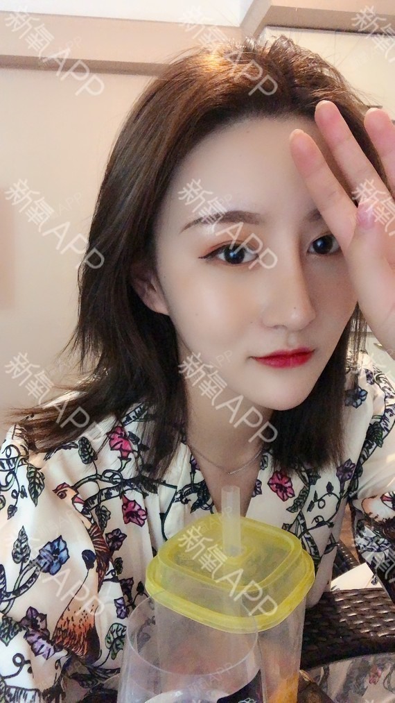 为什么有些人的鼻子一眼就能看出来是做的?