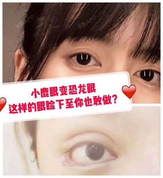 细数当下中国有哪些审美畸形的现象 说到审美畸形 圈子 新氧美容整形