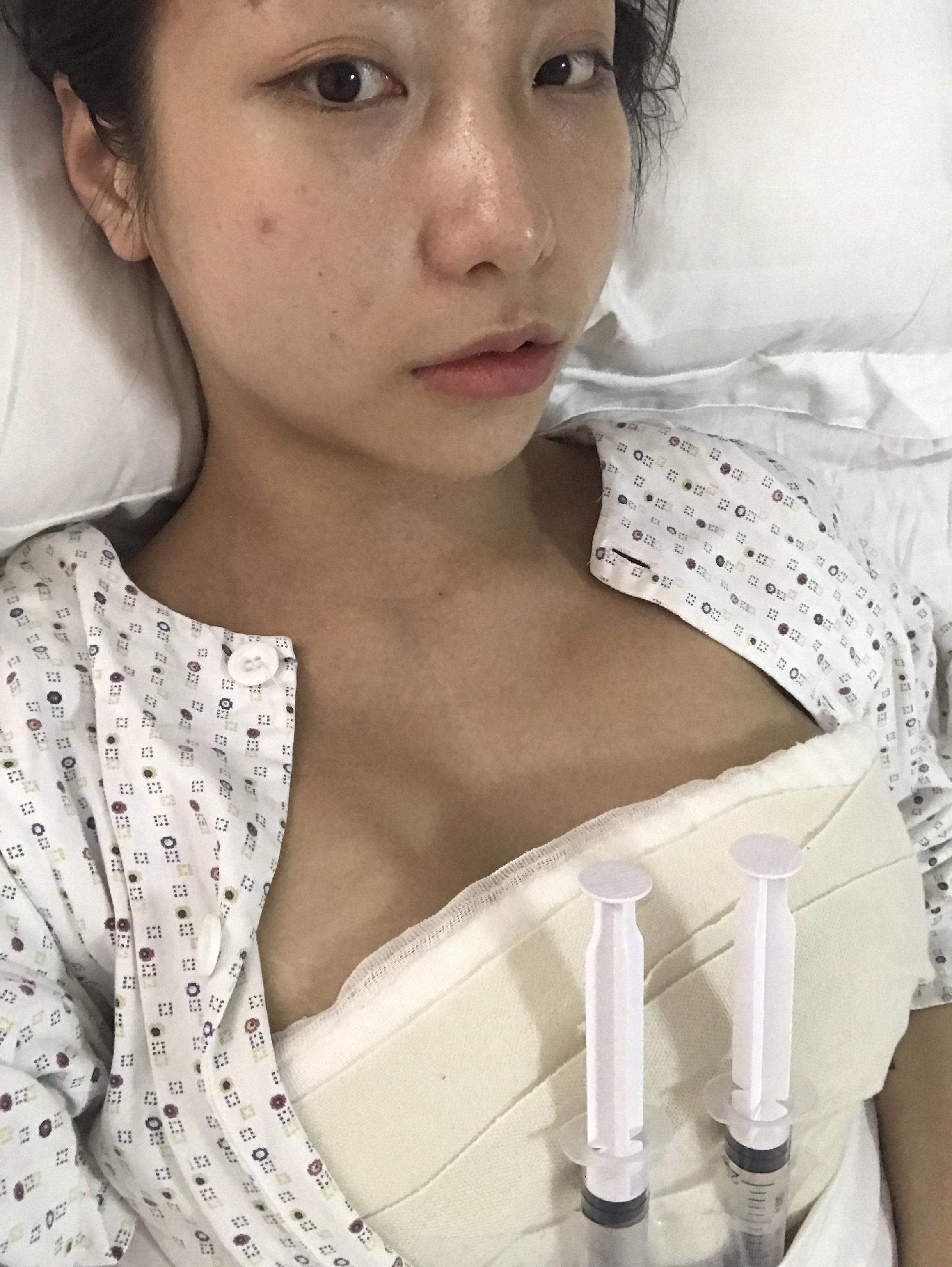 都说有胸才是完美_圈子-新氧美容整形