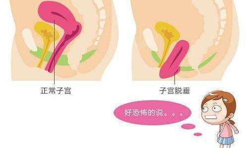 女性缩阴,大体上有三种方法