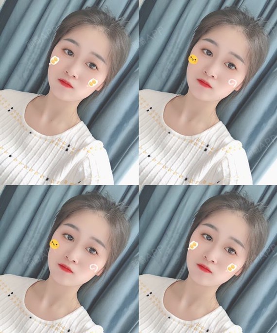 不得不感慨,美颜相机的魅力实在是大,有时候犯懒不想_圈子-新氧美容