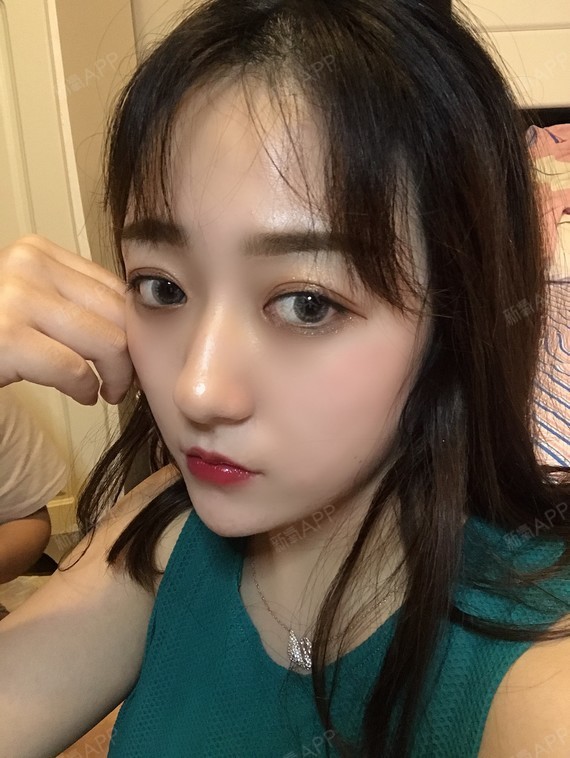 【硅胶隆鼻第45天】