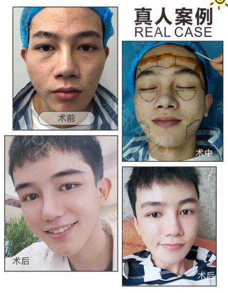 因为苹果肌,所以少女感全无!