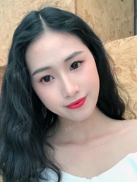 天津超体隆鼻好不好_效果图_天后后天超体隆鼻术后第67天_新氧美容