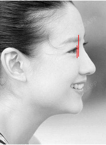 最近发现很多小伙伴还不太明白眉骨对外形的影响