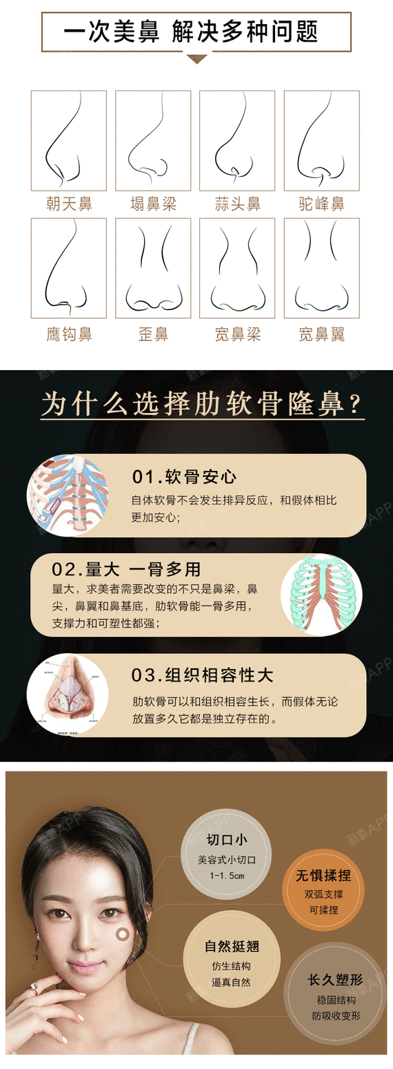 自體肋軟骨隆鼻包含:自體半肋軟骨 雙拱支架 筋膜囊袋 韓式生科假體