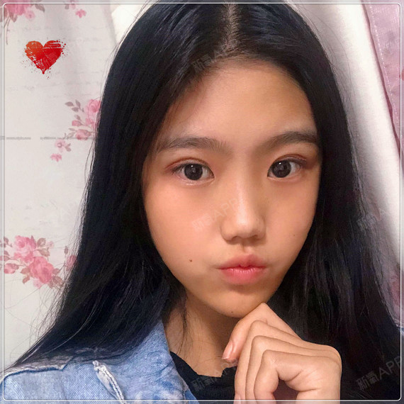 我的恢复速度还是蛮快的,医生告诉我其实双眼皮过了恢_圈子-新氧美容