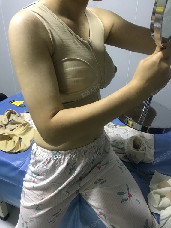 深圳乳房下垂矫正好不好