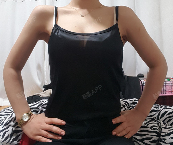 这手臂细的显得我的手好粗哈哈哈 哪里做手指美容拉长_圈子-新氧美容