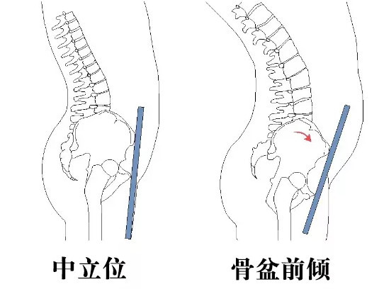 你以为是翘臀,其实它是骨盆前倾.