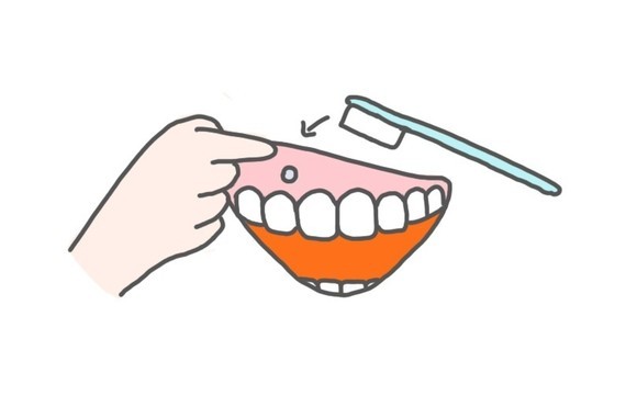 骨钉不能随便打想打就能打的