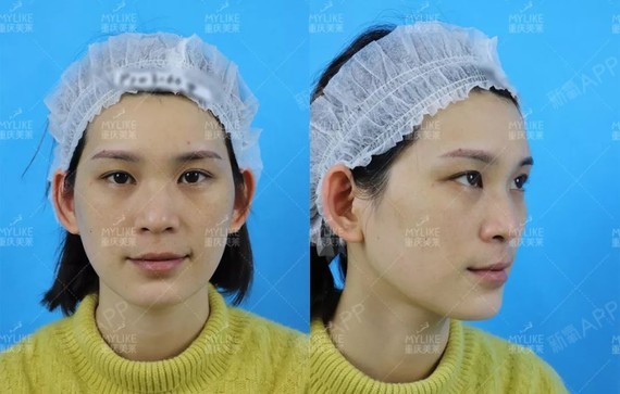 3,smile治养防3步斑源净化术,外祛斑,内修复,防复发.