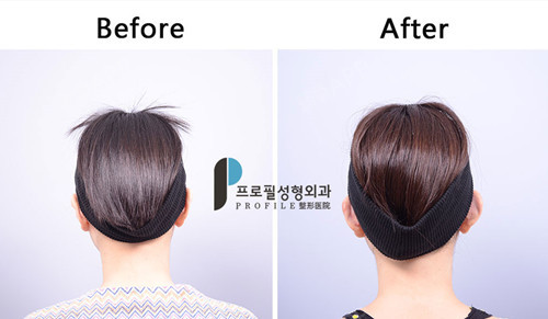 新氧 新氧网 新氧 新氧网