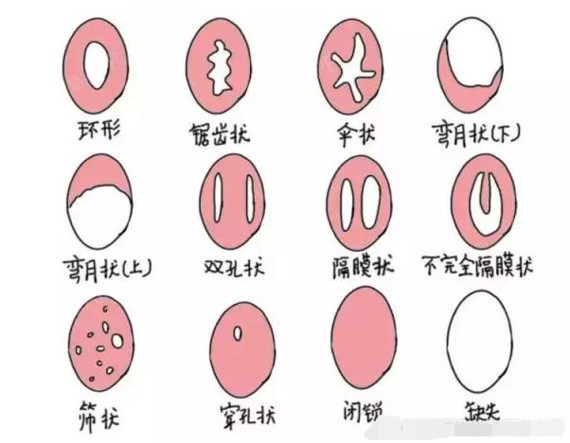 很多面诊的姑娘都很害怕#处女膜修复#会疼,其实不用_圈子-新氧美容