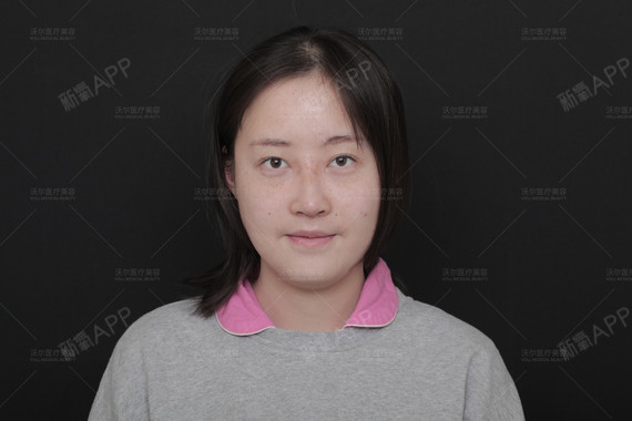关于yuboss美容整形医院的信息 关于yuboss美容整形医院的信息 整形美容