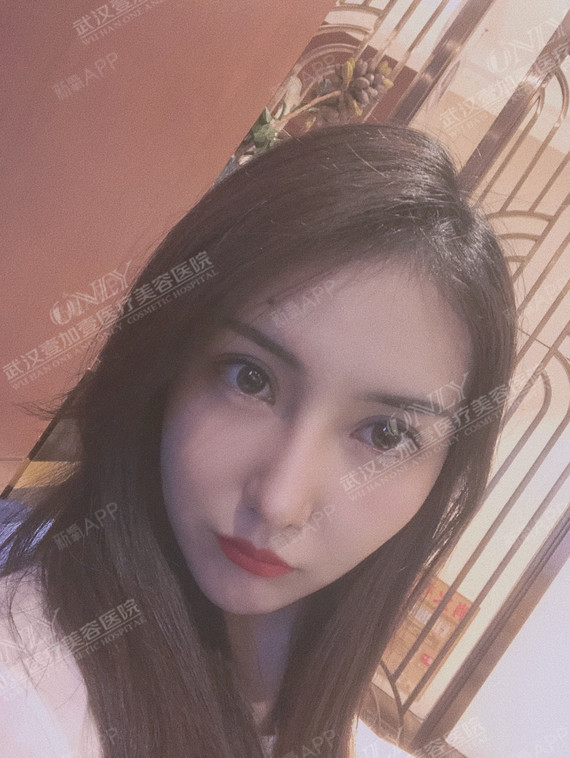 上图让大家看看我的超美眼鼻照,看着就是不是很配