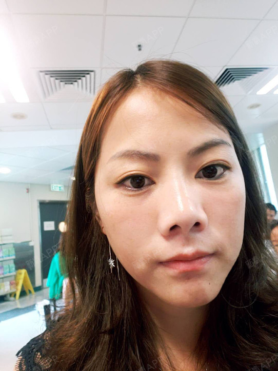 这个位置很微调,_圈子-新氧美容整形